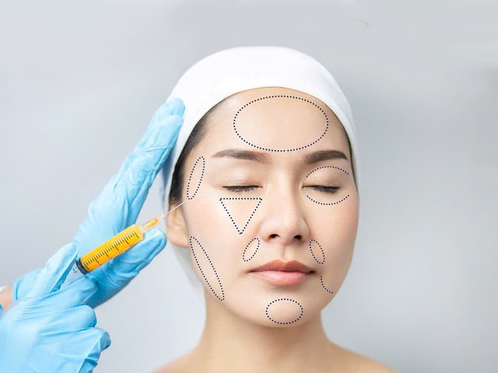 Cấy mỡ tự thân - dịch vụ thẩm mỹ phòng khám Nam Tiến HCM