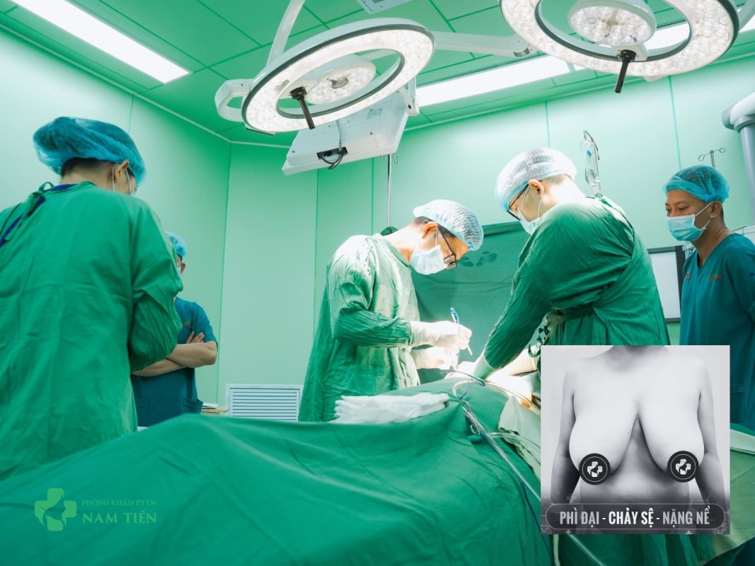 Treo Ngực Sa Trễ TP.HCM - Tiến sĩ bác sĩ Nguyễn Đức Tiến
