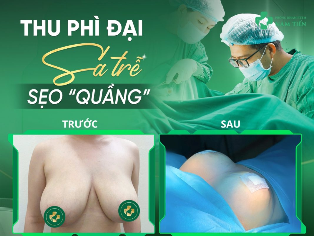 Treo Sa Trễ Ngực An Toàn TP.HCM - BAC SĨ Nguyễn đức Tiến giảng viên ĐHYD HCM