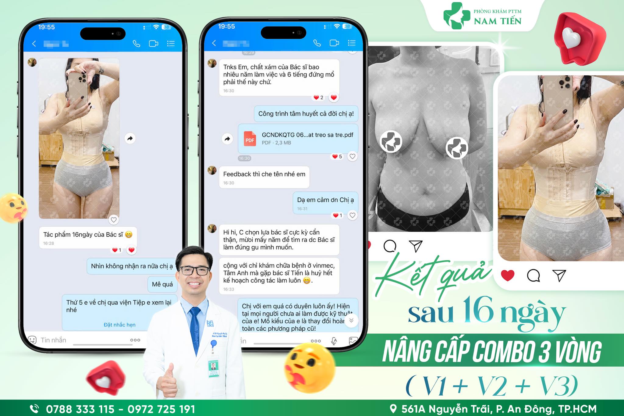 cảm nhận của khách hàng với dịch vụ thẩm mỹ của tiến sĩ bác sĩ nguyễn đức tiến sau nâng ngực