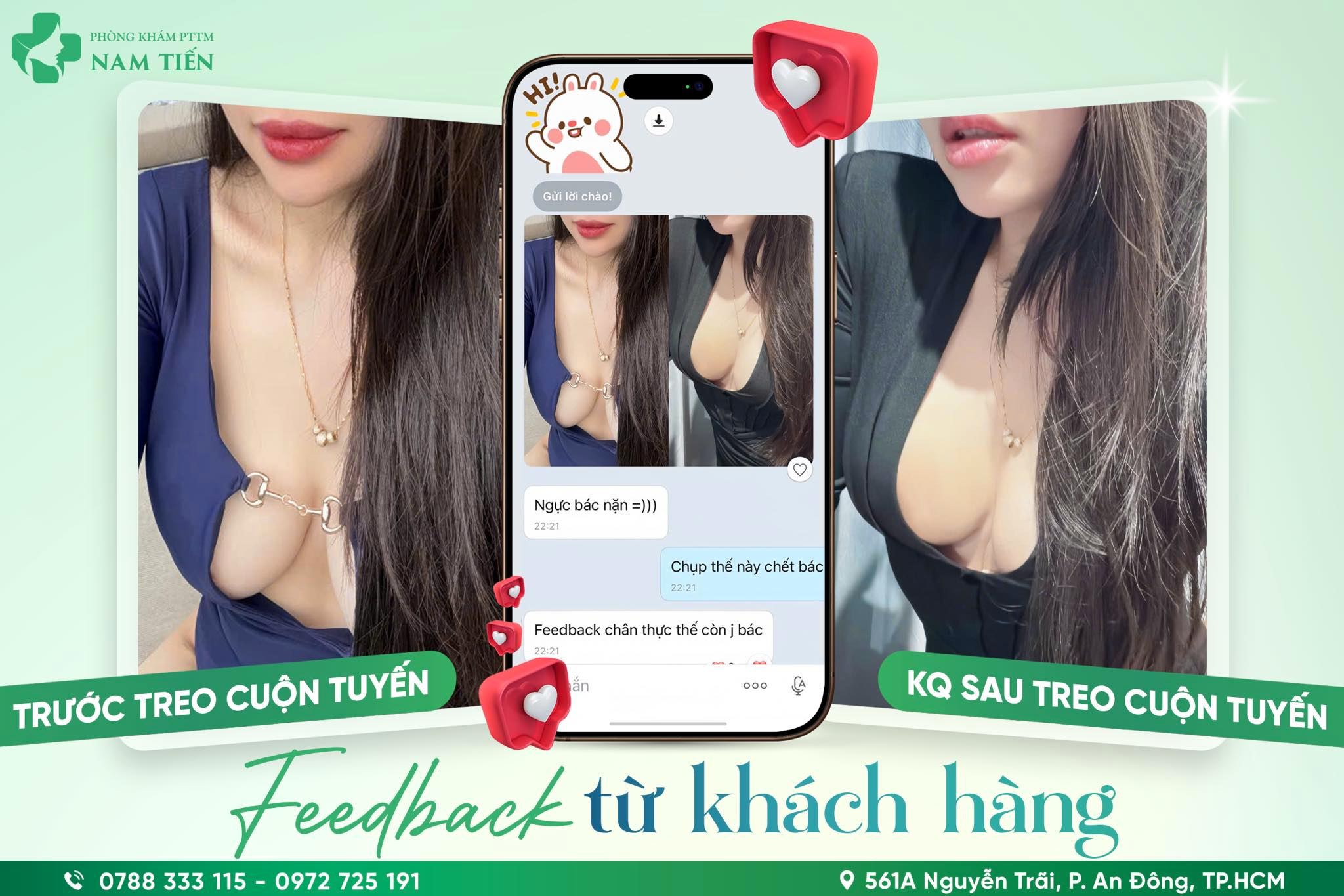 cam nhan cua khach hang voi dich vu tham my cua tien si bac si nguyen duc tien treo cuon tuyen