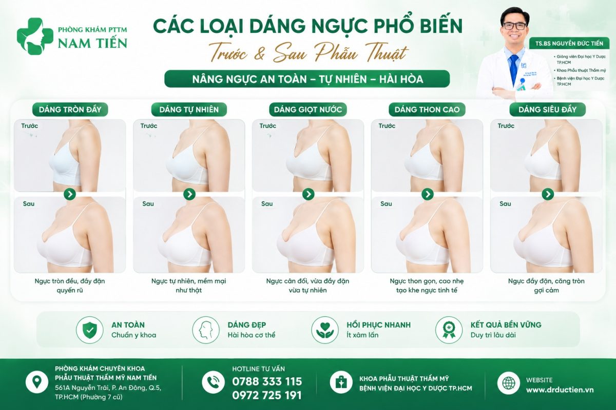 Các dáng ngực phổ biến trước và sau khi nâng ngựa