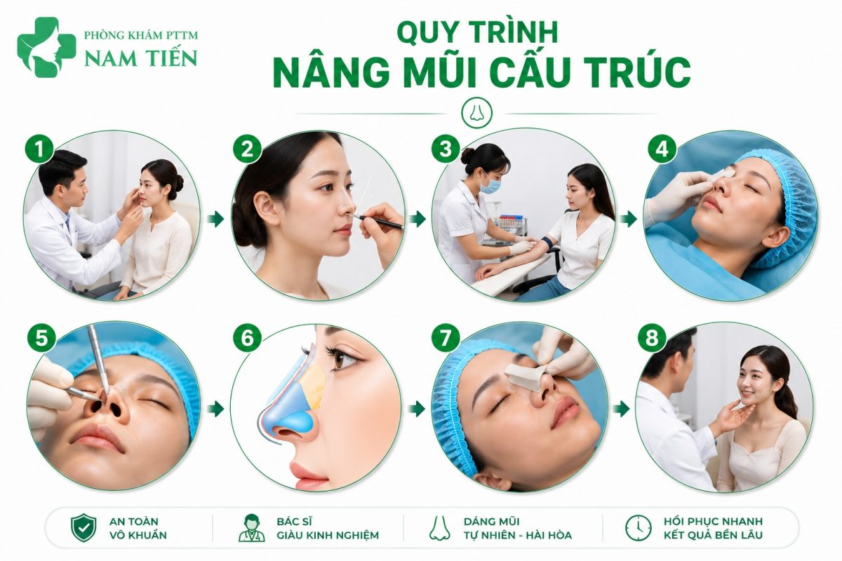 Nâng mũi cấu trúc chuẩn y khoa – kiến tạo dáng mũi hài hòa