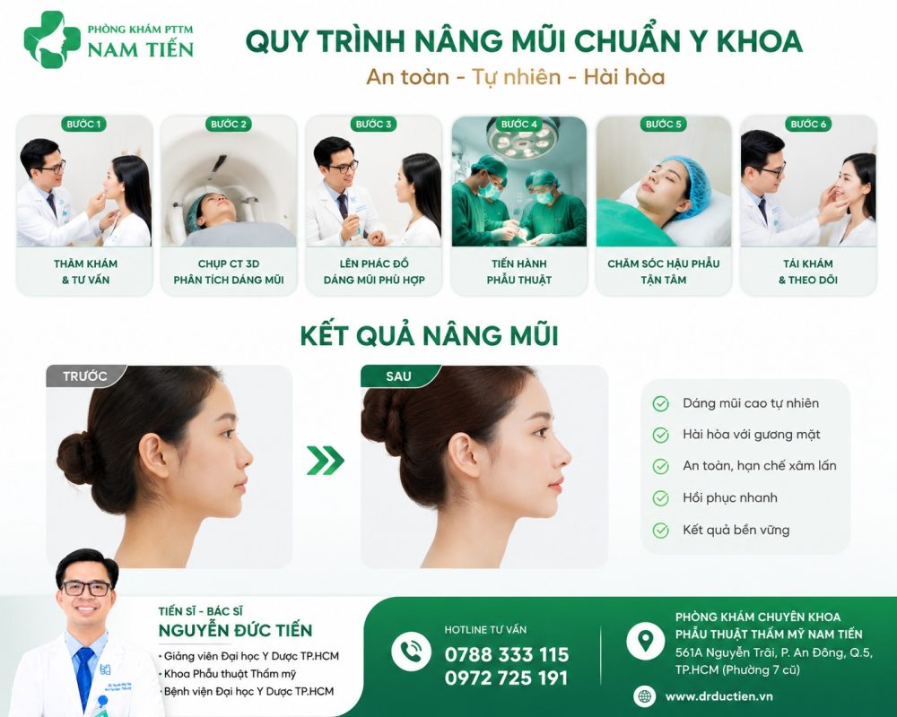 Nâng mũi đẹp tphcm 2 Nâng mũi tphcm cùng BS. Nguyễn Tiến Đức -An toàn, tự nhiên