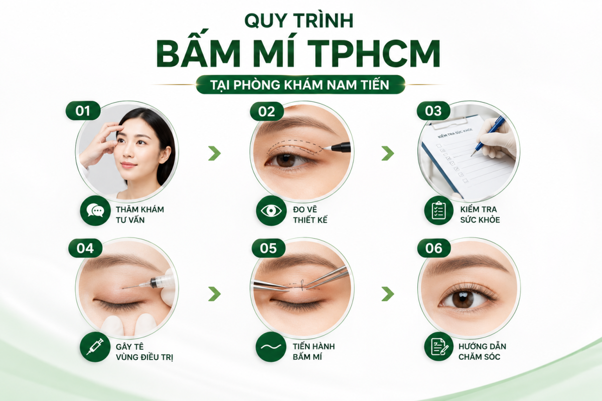 Quy trình thực hiện bấm mí TPHCM tại phòng khám Nam Tiến