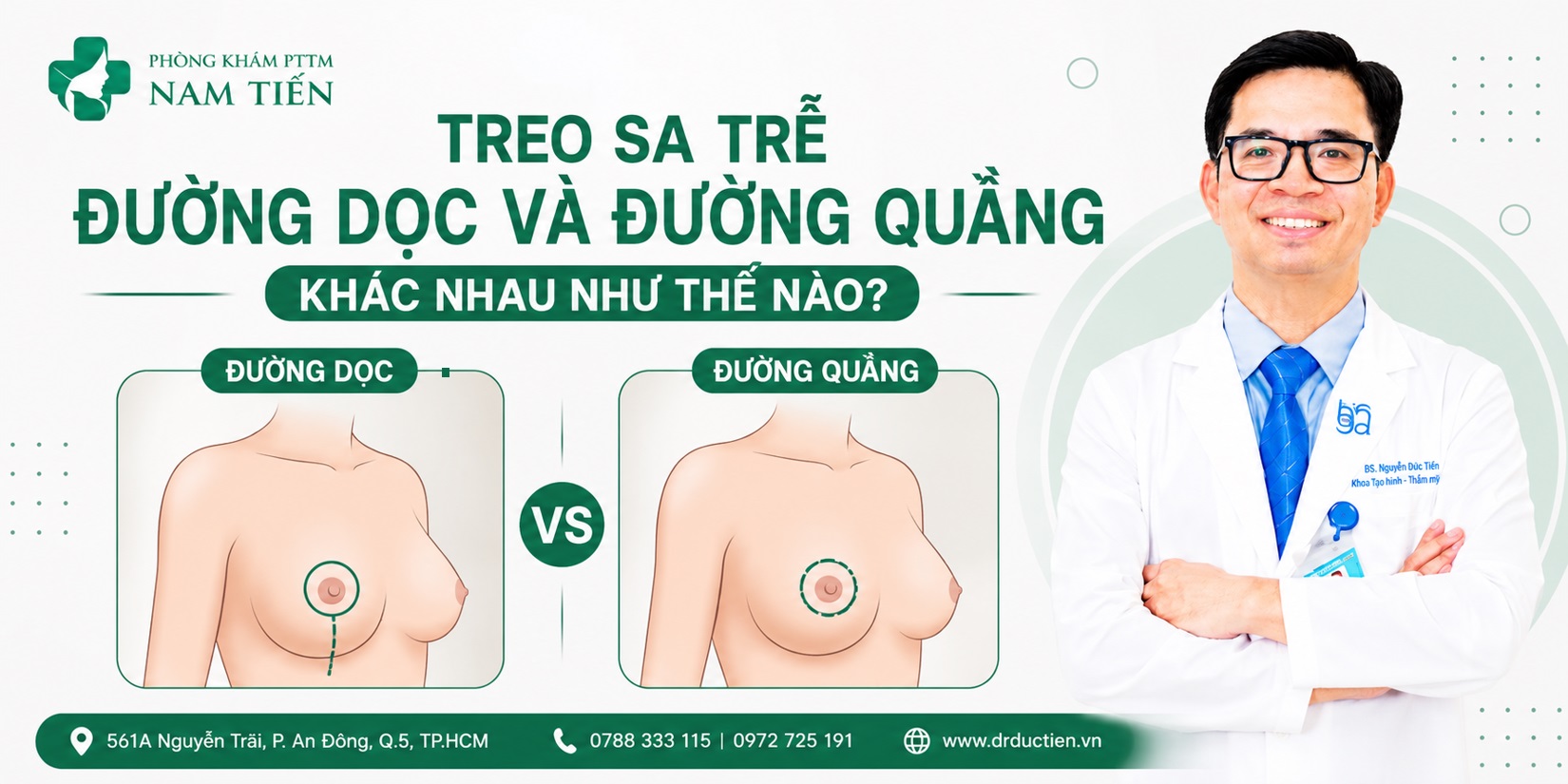 So sánh treo sa trễ đường quầng và đường dọc