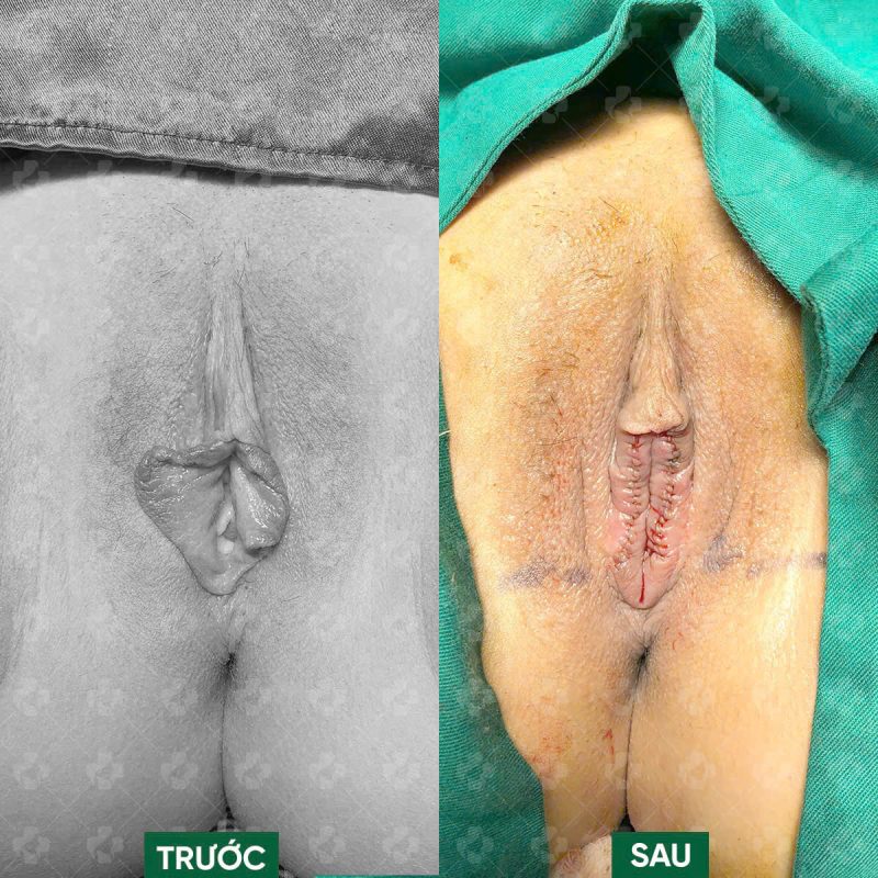 Thẩm mỹ cô bé TPHCM